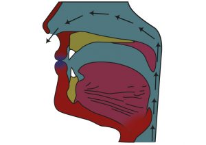 mim 1